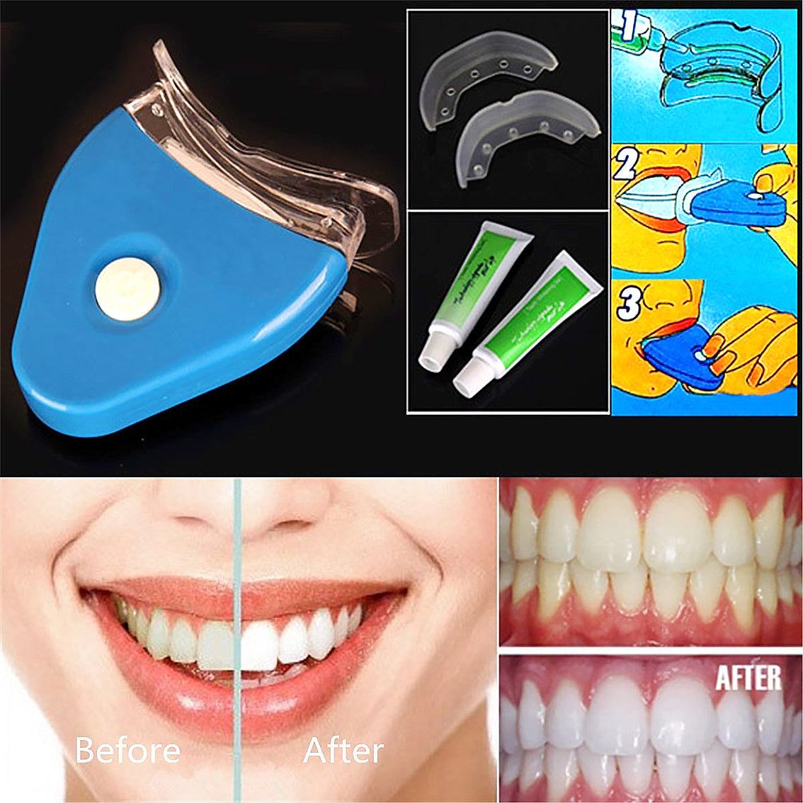 Oral Gel Teeth Tooth Whitening Whitener Dental Bleaching LED